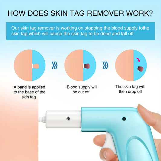 Easy & Painless Removal of Skin Tags