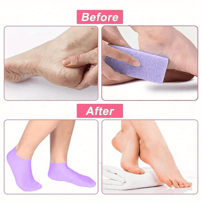 Silicone Socks for Dry Cracked Feet