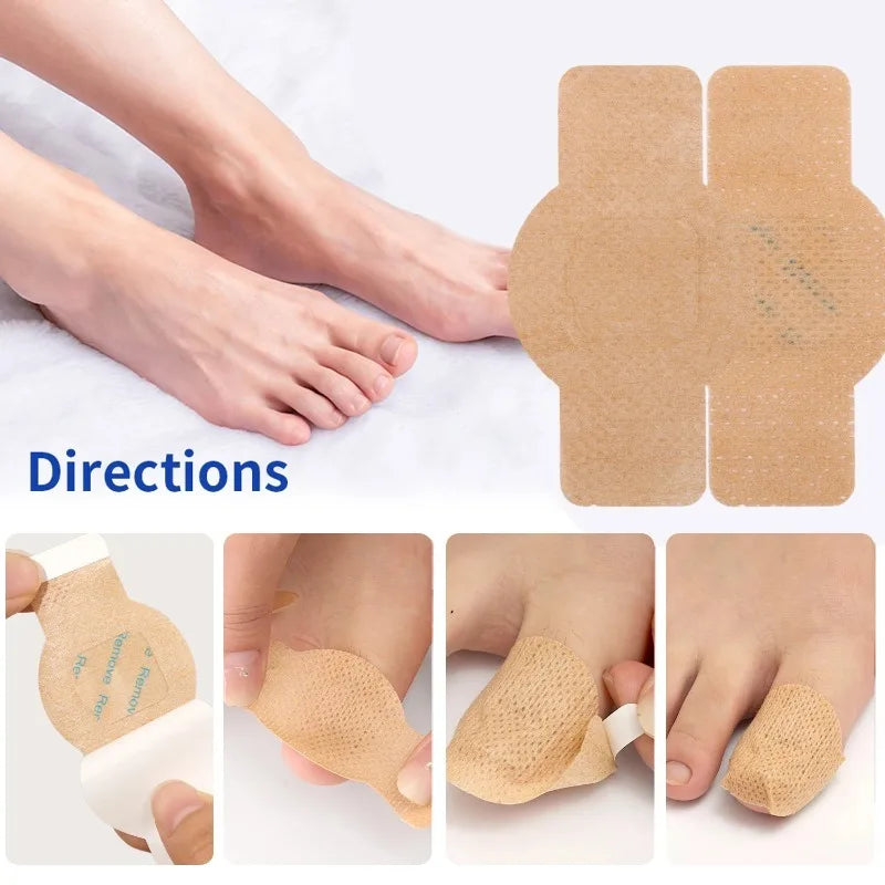 Fungal Nail Patches